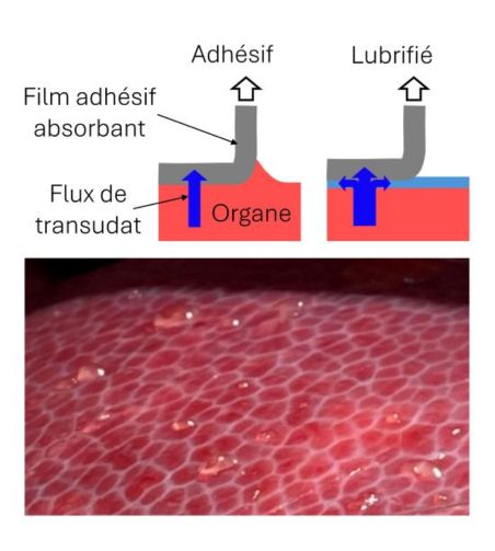 shéma représentatif 