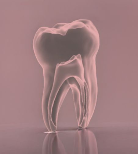 Photo d'une dent