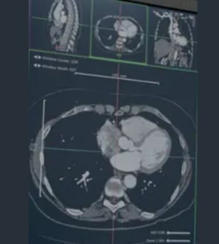 Photo d'une radiographie du cerveau