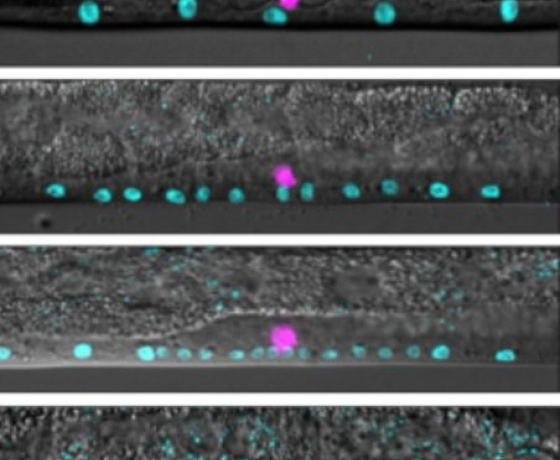 Images microscopiques de l'organe de ponte (vulve) en cours de développement chez le ver C. elegans, le système utilisé par les chercheurs pour mener leur étude.