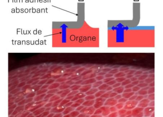 shéma représentatif 