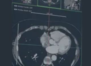 Photo d'une radiographie du cerveau