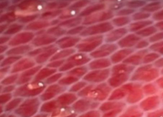 organes et adhesifs chirurgicaux