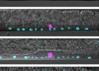 Images microscopiques de l'organe de ponte (vulve) en cours de développement chez le ver C. elegans, le système utilisé par les chercheurs pour mener leur étude.